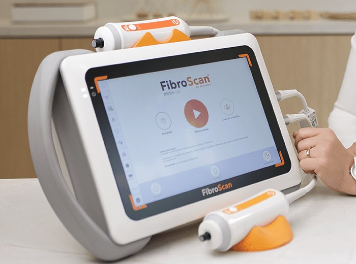 fibroscan1.png